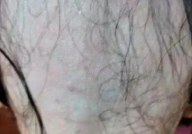 女私密长太多毛太恶心,私密毛发过多困扰？揭秘女性私密护理之道